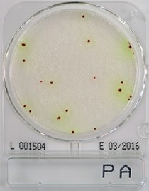 Análisis Microbiológicos